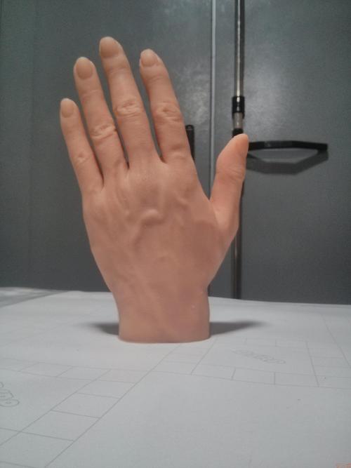 截肢后什么時間安裝假肢好怎么樣假肢發(fā)揮作用(圖1) 截肢后什么時間安裝假肢好怎么樣假肢發(fā)揮作用(圖1)