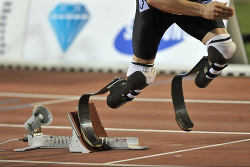 患者安裝臨時(shí)假肢和長(zhǎng)期性假肢區(qū)別在哪(圖1) 患者安裝臨時(shí)假肢和長(zhǎng)期性假肢區(qū)別在哪(圖1)