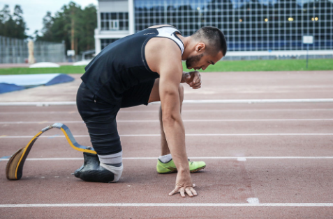 安裝假肢之后是否可以運動健身?(圖2) 假肢