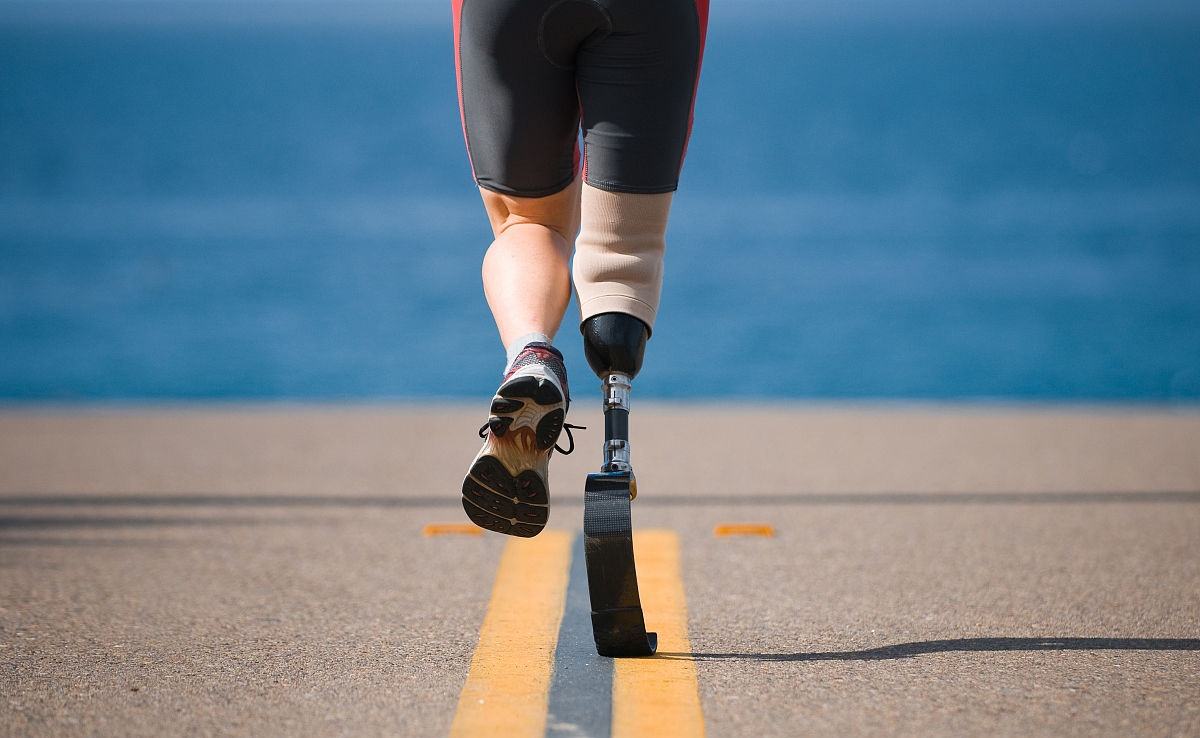 如何將假肢價格的優(yōu)勢充分發(fā)揮出來?(圖1) 假肢價格